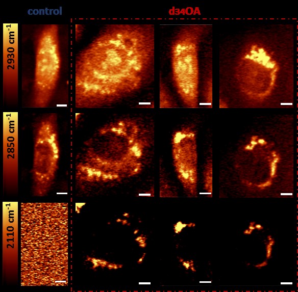 SRS images of HAEC cells. From the left: control and treated for 18h with 200 µM d34OA. Scale bar equals 5 µm. 